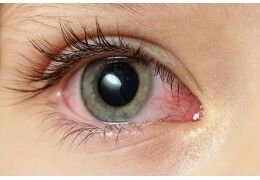 CBD et yeux rouges : mythe ou réalité ?